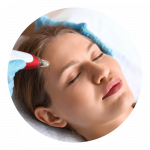 microneedling anikbeautymed