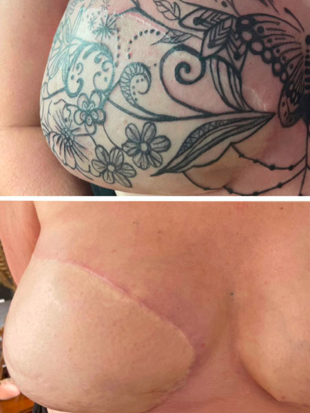 Tattoo anikbeautymed areoles 01