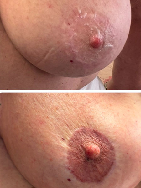 Tattoo anikbeautymed areoles 03