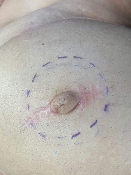 Tattoo anikbeautymed areoles 04