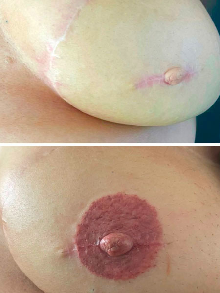 Tattoo anikbeautymed areoles 06