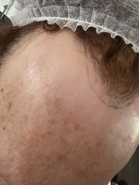 Tattoo anikbeautymed dermapigmentation capillaire 01