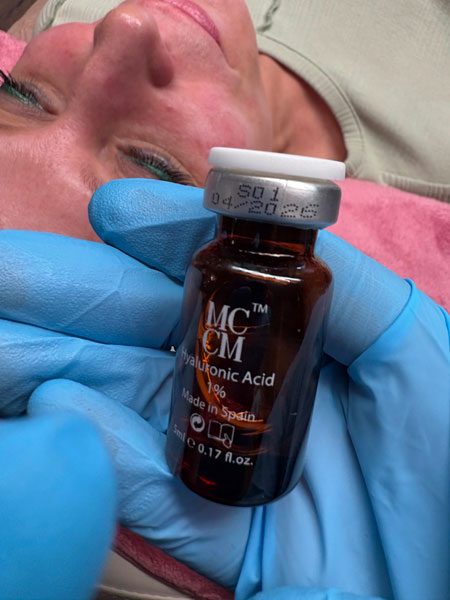 anikbeautymed dermaplaning 02