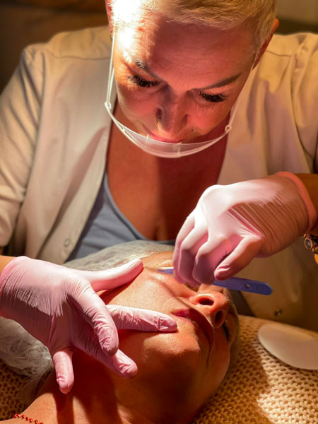 anikbeautymed dermaplaning 04
