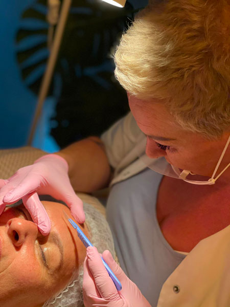 anikbeautymed dermaplaning 05