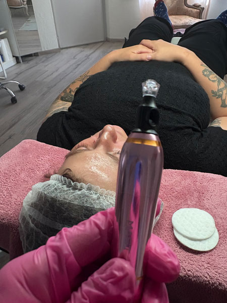anikbeautymed microneedlind 02