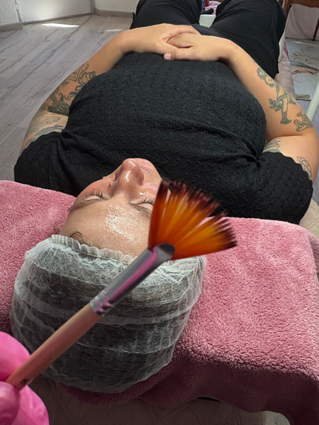 anikbeautymed microneedlind 03