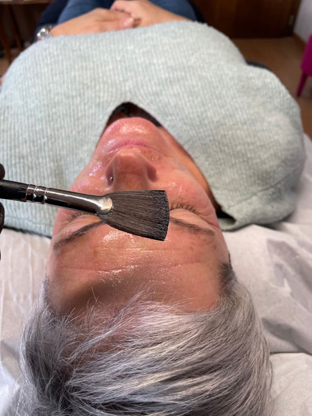 anikbeautymed nanoneeding 02