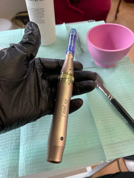 anikbeautymed nanoneeding 03