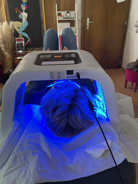 anikbeautymed nanoneeding 04
