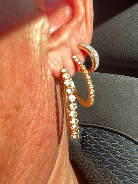 anikbeautymed piercing 01