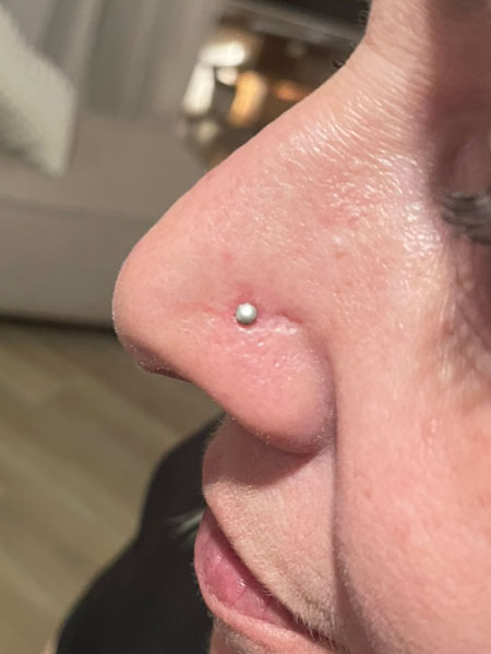anikbeautymed piercing 02
