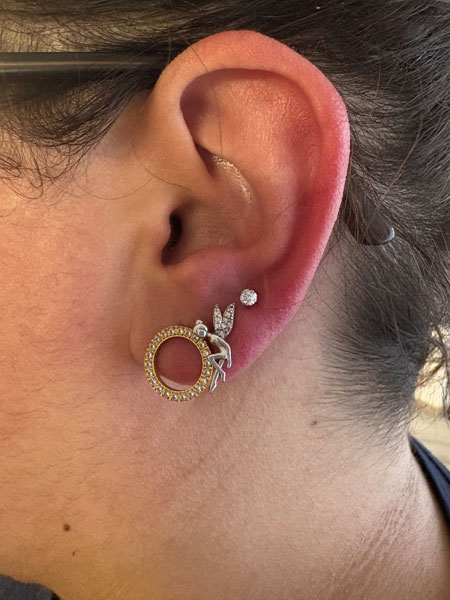 anikbeautymed piercing 03