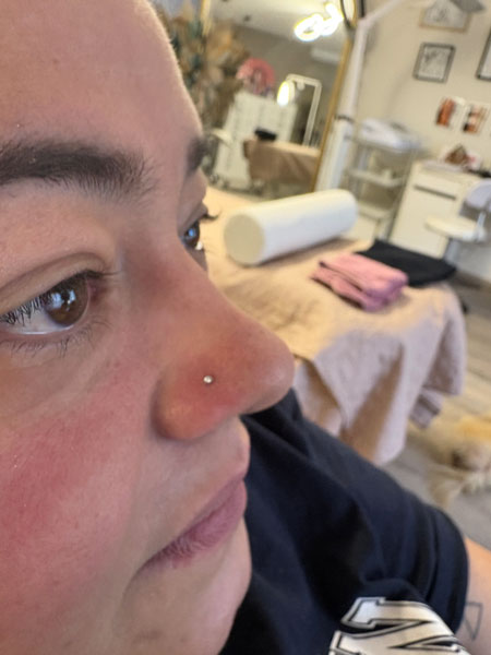 anikbeautymed piercing 04