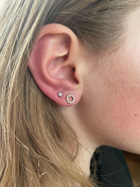 anikbeautymed piercing 05